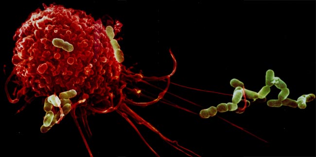 A macrophage seen under an electron microscope, engulfing bacteria