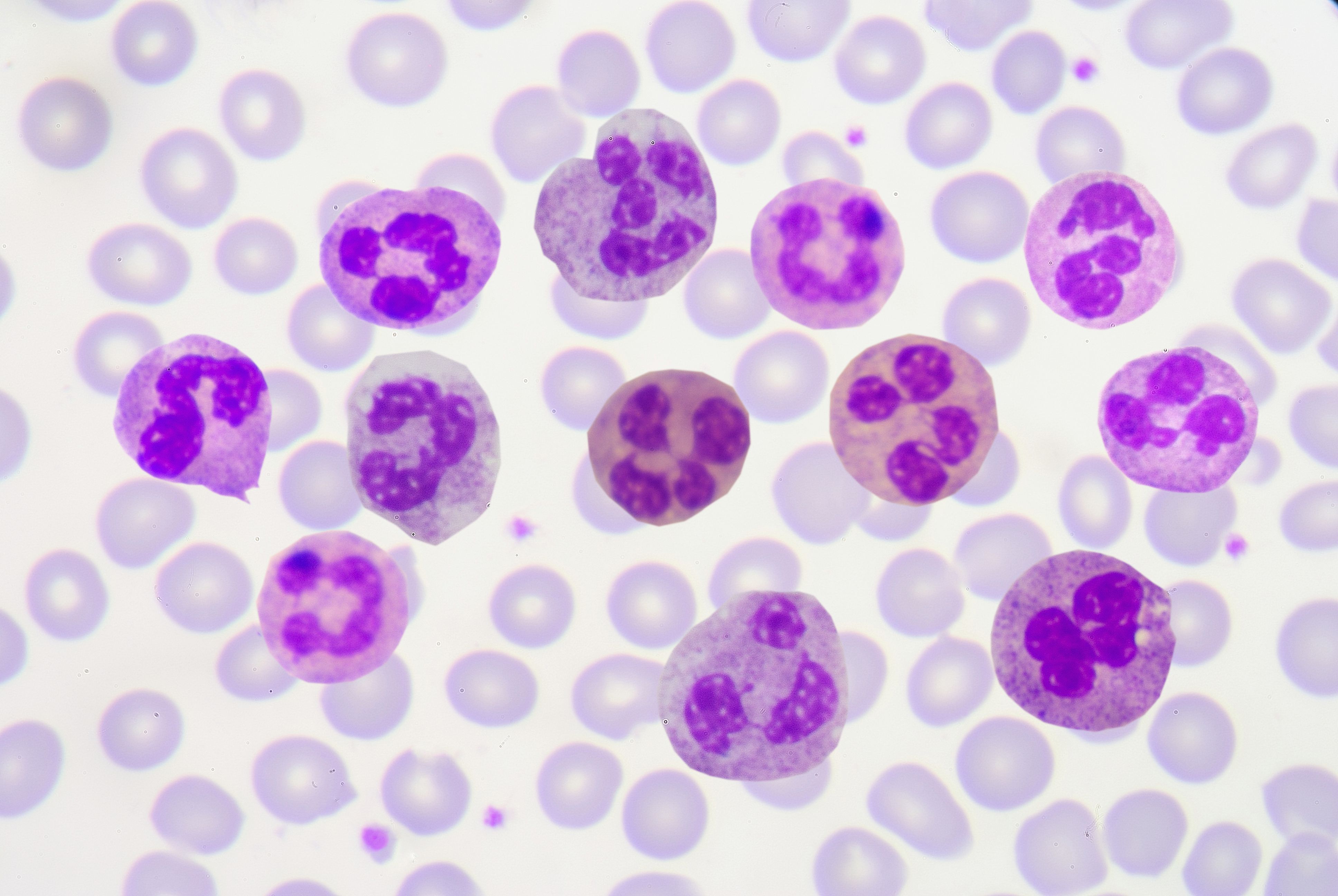 Neutrophils in a stained blood smear